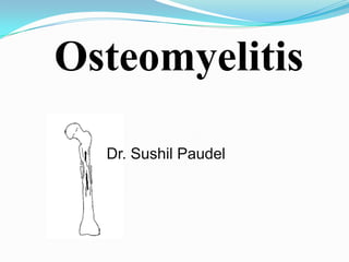Osteomyelitis
Dr. Sushil Paudel
 