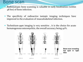  Ga67 scintigraphy provides the best way to detect
vertebral osteomyelitis radiologically.
 In111 labeled leucocyte imag...