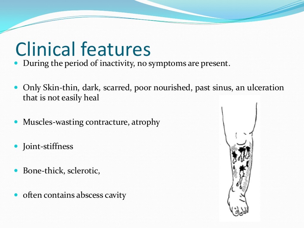 Osteomyelitis