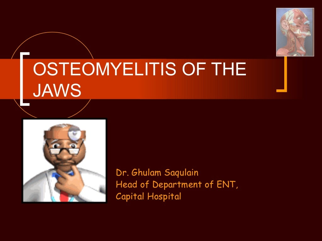 Osteomyelitis