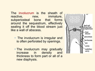 Vascular thrombosis
Bone necrosis (Sequestrum formation)
New bone formation occur (Involucrum)
Multiple openings appear in this involucrum, through
which exudates & debris from the sequestrum
pass via the sinuses
(Sinus formation)
41
CHRONIC OSTEOMYELITIS
 