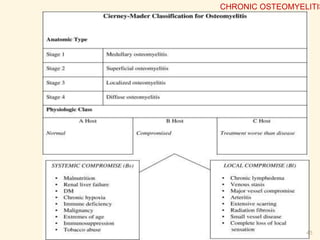 SEQUESTRUM
PERIOSTEAL NEW BONE
FORMATION
INVOLUCRUM
CHRONIC OSTEOMYELITIS
 
