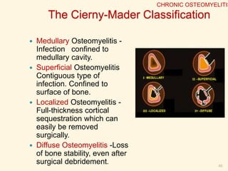 INVOLUCRUM (the new bone)
46
CHRONIC OSTEOMYELITIS
 
