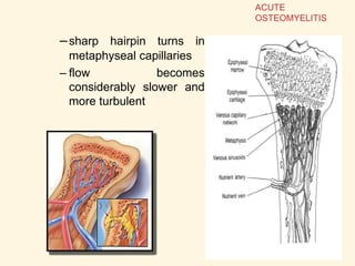 –sharp hairpin turns in
metaphyseal capillaries
– flow becomes
considerably slower and
more turbulent
ACUTE
OSTEOMYELITIS
 