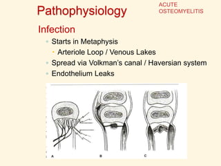 Pathophysiology
Infection
◦ Starts in Metaphysis
 Arteriole Loop / Venous Lakes
◦ Spread via Volkman’s canal / Haversian system
◦ Endothelium Leaks
ACUTE
OSTEOMYELITIS
 