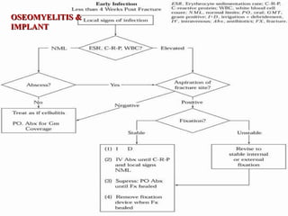Sequestrectomy and curettage. A, Affected bone is exposed, and sequestrum is
removed. B, All infected matter is removed. C, Wound is either packed open or closed
loosely over drains.
 