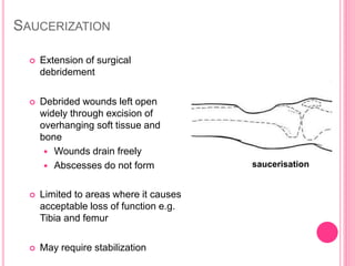 SAUCERIZATION
 Extension of surgical
debridement
 Debrided wounds left open
widely through excision of
overhanging soft tissue and
bone
 Wounds drain freely
 Abscesses do not form
 Limited to areas where it causes
acceptable loss of function e.g.
Tibia and femur
 May require stabilization
saucerisation
 