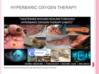HYPERBARIC OXYGEN THERAPY
 