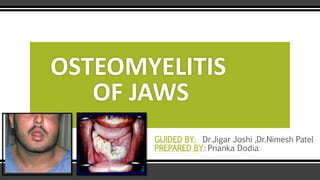 OSTEOMYELITIS
OF JAWS
GUIDED BY: Dr.Jigar Joshi ,Dr.Nimesh Patel
PREPARED BY: Prianka Dodia
 
