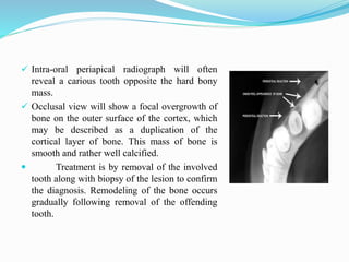  Intra-oral periapical radiograph will often
reveal a carious tooth opposite the hard bony
mass.
 Occlusal view will show a focal overgrowth of
bone on the outer surface of the cortex, which
may be described as a duplication of the
cortical layer of bone. This mass of bone is
smooth and rather well calcified.
 Treatment is by removal of the involved
tooth along with biopsy of the lesion to confirm
the diagnosis. Remodeling of the bone occurs
gradually following removal of the offending
tooth.
 