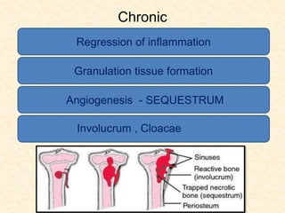 Chronic
Regression of inflammation
Granulation tissue formation
Angiogenesis - SEQUESTRUM
Involucrum , Cloacae
 