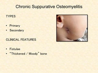 Chronic Suppurative Osteomyelitis
TYPES
• Primary
• Secondary
CLINICAL FEATURES
• Fistulae
• “Thickened / Woody” bone
 