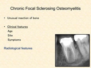 Chronic Focal Sclerosing Osteomyelitis
• Unusual reaction of bone
• Clinical features
Age
Site
Symptoms
Radiological features
 