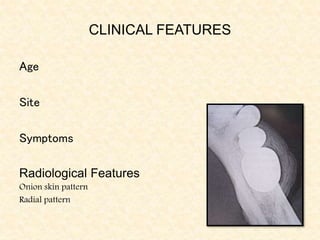 CLINICAL FEATURES
Age
Site
Symptoms
Radiological Features
Onion skin pattern
Radial pattern
 