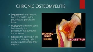 CHRONIC OSTEOMYELITIS
 Sequestrum is the necrotic
bone embedded in the
pus/infected granulation
tissue
 Involucrum is the new bone
laid down by the
periosteum that surrounds
the sequestra.
 Cloaca is the opening in the
involucrum through which
pus & sequestra make their
way out
 