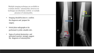 Multiple imaging technique are available to
evaluate chronic osteomyelitis ,however no
technique can absolutely confirm or exclude
presence of osteomyelitis.
• Imaging should be done to confirm
the diagnosis and prepare for
surgery.
• Initial plain radiographs to be
performed it yields valuable info .
• Signs of cortical destruction and
periosteal reaction strongly suggest
the diagnosis of osteomyelitis.
 