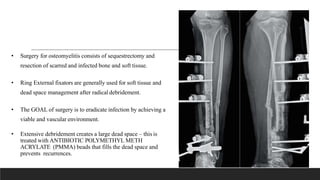 • Surgery for osteomyelitis consists of sequestrectomy and
resection of scarred and infected bone and soft tissue.
• Ring External fixators are generally used for soft tissue and
dead space management after radical debridement.
• The GOAL of surgery is to eradicate infection by achieving a
viable and vascular environment.
• Extensive debridement creates a large dead space – this is
treated with ANTIBIOTIC POLYMETHYL METH
ACRYLATE (PMMA) beads that fills the dead space and
prevents recurrences.
 