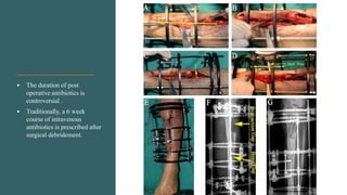 • The duration of post
operative antibiotics is
controversial .
• Traditionally, a 6 week
course of intravenous
antibiotics is prescribed after
surgical debridement.
 