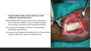 • SEQUESTRECTOMY AND CURETTAGE FOR
CHRONIC OSTEOMYELITIS
SEQUESTRECTOMY means removal of the sequestrum, if
it lies within the medullary cavity, a window is made in
the overlying involucrum and the sequestrum removed .
One must wait for adequate involucrum formation before
performing sequestrectomy.
Sinus tracks can be injected with methylene blue 24 hours before
surgery to make them easier to locate and excise.
 