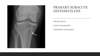 PRIMARY SUBACUTE
OSTEOMYELITIS
Brodie abscess
Garres’osteomyelitis
Salmonella osteomyelitis
 