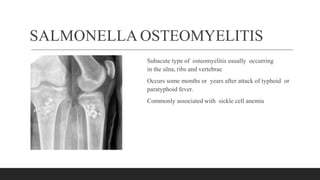SALMONELLA OSTEOMYELITIS
Subacute type of osteomyelitis usually occurring
in the ulna, ribs and vertebrae
Occurs some months or years after attack of typhoid or
paratyphoid fever.
Commonly associated with sickle cell anemia
 