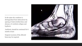 In the spine the condition is
distinguished from tuberculosis by
sparing of intervertebral discs and
absence of vertebral collapse and
kyphosis.
Antibiotic should be continued for 6
month at least.
Surgical excision of the affected
bone may be required.
 