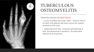 TUBERCULOUS
OSTEOMYELITIS
Tuberculous dactylitis aka Spina Ventosa
~ occurs in children and young adults ~ infection starts in
the shaft of the phalanx and causes erosion and gradual
destruction of the bone
~ subperiosteal new bone formation and thickening of
bone this phenomenon is peculiar to the tuberculous
infection in the long bones.
 
