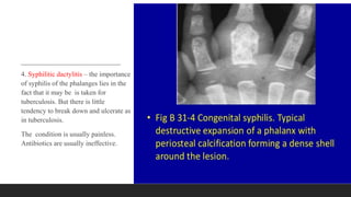 4. Syphilitic dactylitis – the importance
of syphilis of the phalanges lies in the
fact that it may be is taken for
tuberculosis. But there is little
tendency to break down and ulcerate as
in tuberculosis.
The condition is usually painless.
Antibiotics are usually ineffective.
 
