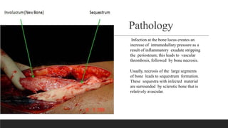 Pathology
Infection at the bone locus creates an
increase of intramedullary pressure as a
result of inflammatory exudate stripping
the periosteum; this leads to vascular
thrombosis, followed by bone necrosis.
Usually, necrosis of the large segments
of bone leads to sequestrum formation.
These sequestra with infected material
are surrounded by sclerotic bone that is
relatively avascular.
 