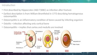 Introduction
• First described by Hippocrates (460-730BC) as infection after fracture
• Earliest description is from William Bromfieled in 1773 describing hematogenous
osteomyelitis
• Osteomyelitis is an inflammatory condition of bone caused by infecting organism
• Osteitis = infection affecting only cortical bone
• Osteomyelitis = implies that cortex and medulla are involved
 