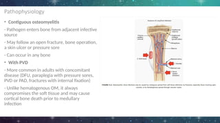 Pathophysiology
• Contiguous osteomyelitis
- Pathogen enters bone from adjacent infective
source
- May follow an open fracture, bone operation,
a skin ulcer or pressure sore
- Can occur in any bone
• With PVD
- More common in adults with concomitant
disease (DFU, paraplegia with pressure sores,
PVD or PAD, fractures with internal fixation)
- Unlike hematogenous OM, it always
compromises the soft tissue and may cause
cortical bone death prior to medullary
infection
 