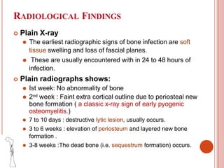Button Sequesterum Sign osteomyelitis-Types, clinic features and treatment.pptx