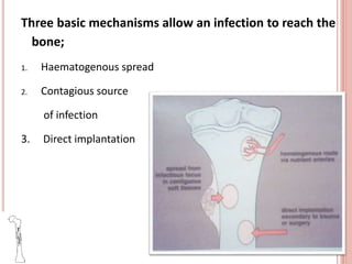 Three basic mechanisms allow an infection to reach the
bone;
1. Haematogenous spread
2. Contagious source
of infection
3. Direct implantation
 