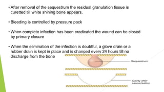 • After removal of the sequestrum the residual granulation tissue is
curetted till white shining bone appears.
• Bleeding is controlled by pressure pack
• When complete infection has been eradicated the wound can be closed
by primary closure
• When the elimination of the infection is doubtful, a glove drain or a
rubber drain is kept in place and is changed every 24 hours till no
discharge from the bone
 