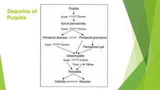 Sequelae of
Pulpitis
 
