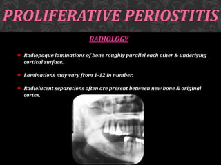 PROLIFERATIVE PERIOSTITIS
RADIOLOGY
Radiopaque laminations of bone roughly parallel each other & underlying
cortical surface.
Laminations may vary from 1-12 in number.
Radiolucent separations often are present between new bone & original
cortex.
 