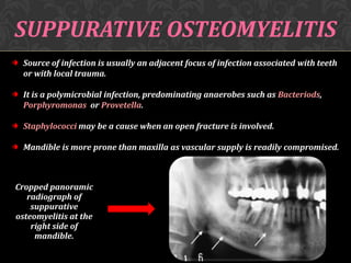 SUPPURATIVE OSTEOMYELITIS
Source of infection is usually an adjacent focus of infection associated with teeth
or with local trauma.
It is a polymicrobial infection, predominating anaerobes such as Bacteriods,
Porphyromonas or Provetella.
Staphylococci may be a cause when an open fracture is involved.

Mandible is more prone than maxilla as vascular supply is readily compromised.

Cropped panoramic
radiograph of
suppurative
osteomyelitis at the
right side of
mandible.

 