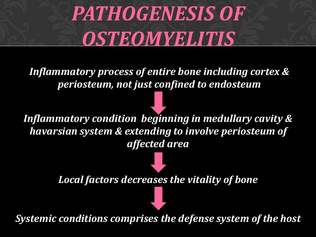 Osteomyelitis of jaw