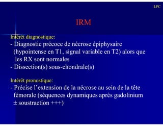 IRM
Intérêt diagnostique:
- Diagnostic précoce de nécrose épiphysaire
(hypointense en T1, signal variable en T2) alors que
les RX sont normales
LPC
- Dissection(s) sous-chondrale(s)
Intérêt pronostique:
- Précise l’extension de la nécrose au sein de la tête
fémorale (séquences dynamiques après gadolinium
± soustraction +++)
 