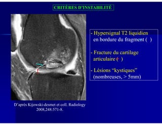 CRITÈRES D’INSTABILITÉ
- Hypersignal T2 liquidien
en bordure du fragment ( )
- Fracture du cartilage
articulaire ( )
D’après Kijowski-desmet et coll. Radiology
2008,248:571-8.
- Lésions “kystiques”
(nombreuses, > 5mm)
 
