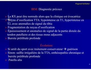 IRM: Diagnostic précoce
La RX peut être normale alors que la clinique est évocatrice
Noyau d’ossification TTA: hypointense en T1, hyperintense en
T2, avec anomalies de signal du tibia
Fragmentation du noyau d’ossification
Épaississement et anomalies de signal de la partie distale du
tendon patellaire et des tissus mous adjacents
Osgood-Schlatter
3939
tendon patellaire et des tissus mous adjacents
Bursite prétibiale profonde
Évolution:
Si arrêt du sport avec traitement conservateur guérison
Sinon: saillie irrégulière de la TTA, enthésopathie chronique et
bursite prétibiale profonde
Patella alta
 