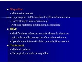 Séquelles:Séquelles:
-- Métatarsiens courtsMétatarsiens courts
-- Hypertrophie et déformation des têtes métatarsiennesHypertrophie et déformation des têtes métatarsiennes
-- Corps étranger intraCorps étranger intra--articulaire pfarticulaire pf
-- Arthrose métatarsoArthrose métatarso--phalangienne secondairephalangienne secondaire
IRM:IRM:
-- Modifications précoces non spécifiques de signal auModifications précoces non spécifiques de signal au
sein de la moelle osseuse des têtes métatarsiennessein de la moelle osseuse des têtes métatarsiennes
-- Épanchement intraÉpanchement intra--articulaire non spécifique associéarticulaire non spécifique associé
Traitement:Traitement:
-- Médical, orthèseMédical, orthèse
-- Chirurgical, au stade de séquellesChirurgical, au stade de séquelles
 