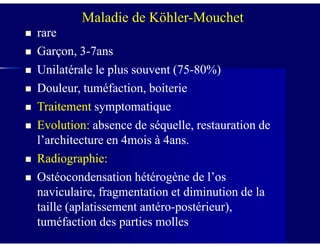 Maladie de Köhler-Mouchet
rarerare
Garçon, 3Garçon, 3--7ans7ans
Unilatérale le plus souvent (75Unilatérale le plus souvent (75--80%)80%)
Douleur, tuméfaction, boiterieDouleur, tuméfaction, boiterie
TraitementTraitement symptomatiquesymptomatique
Evolution:Evolution: absence de séquelle, restauration deabsence de séquelle, restauration deEvolution:Evolution: absence de séquelle, restauration deabsence de séquelle, restauration de
l’architecture en 4mois à 4ans.l’architecture en 4mois à 4ans.
Radiographie:Radiographie:
Ostéocondensation hétérogène de l’osOstéocondensation hétérogène de l’os
naviculaire, fragmentation et diminution de lanaviculaire, fragmentation et diminution de la
taille (aplatissement antérotaille (aplatissement antéro--postérieur),postérieur),
tuméfaction des parties mollestuméfaction des parties molles
 