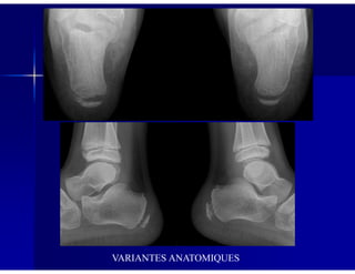 VARIANTES ANATOMIQUES
 