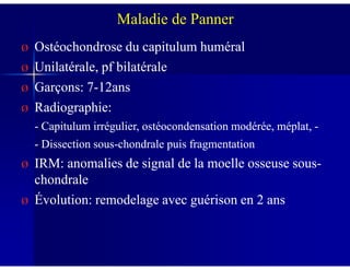 ØØ Ostéochondrose du capitulum huméralOstéochondrose du capitulum huméral
ØØ Unilatérale, pf bilatéraleUnilatérale, pf bilatérale
ØØ Garçons: 7Garçons: 7--12ans12ans
ØØ Radiographie:Radiographie:
-- Capitulum irrégulier, ostéocondensation modérée, méplat,Capitulum irrégulier, ostéocondensation modérée, méplat, --
Maladie de Panner
-- Dissection sousDissection sous--chondrale puis fragmentationchondrale puis fragmentation
ØØ IRM: anomalies de signal de la moelle osseuse sousIRM: anomalies de signal de la moelle osseuse sous--
chondralechondrale
ØØ ÉÉvolution: remodelage avec guérison en 2 ansvolution: remodelage avec guérison en 2 ans
 