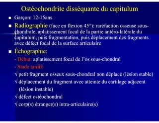 Garçon: 12Garçon: 12--15ans15ans
RadiographieRadiographie (face en flexion 45(face en flexion 45°°): raréfaction osseuse sous): raréfaction osseuse sous--
chondrale, aplatissement focal de la partie antérochondrale, aplatissement focal de la partie antéro--latérale dulatérale du
capitulum, puis fragmentation, puis déplacement des fragmentscapitulum, puis fragmentation, puis déplacement des fragments
avec défect focal de la surface articulaireavec défect focal de la surface articulaire
ÉÉchographie:chographie:
-- Début:Début: aplatissement focal de l’os sousaplatissement focal de l’os sous--chondralchondral
Ostéochondrite disséquante du capitulum
-- Début:Début: aplatissement focal de l’os sousaplatissement focal de l’os sous--chondralchondral
-- Stade tardif:Stade tardif:
√ petit fragment osseux sous√ petit fragment osseux sous--chondral non déplacé (lésion stable)chondral non déplacé (lésion stable)
√ déplacement du fragment avec atteinte du cartilage adjacent√ déplacement du fragment avec atteinte du cartilage adjacent
(lésion instable)(lésion instable)
√ défect ostéochondral√ défect ostéochondral
√ corp(s) étranger(s) intra√ corp(s) étranger(s) intra--articulaire(s)articulaire(s)
 