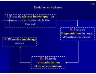I.I. Phase de nécrose ischémique du
noyau d’ossification de la tête
fémorale
II.II. Phase de
fragmentation du noyau
d’ossification fémoral
Évolution en 4 phases
LPC
d’ossification fémoral
III.III. Phase de
revascularisation
et de reconstruction
IV.IV. Phase de remodelage
osseux
 