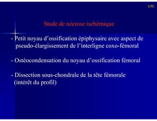 Stade de nécrose ischémique
- Petit noyau d’ossification épiphysaire avec aspect de
pseudo-élargissement de l’interligne coxo-fémoral
- Ostéocondensation du noyau d’ossification fémoral
LPC
- Ostéocondensation du noyau d’ossification fémoral
- Dissection sous-chondrale de la tête fémorale
(intérêt du profil)
 