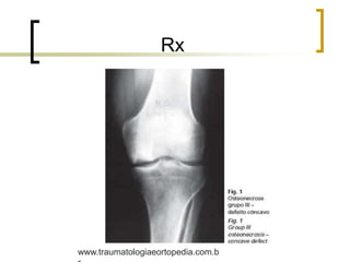 Rx
www.traumatologiaeortopedia.com.b
 