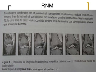 RNM
www.traumatologiaeortopedia.com.b
 